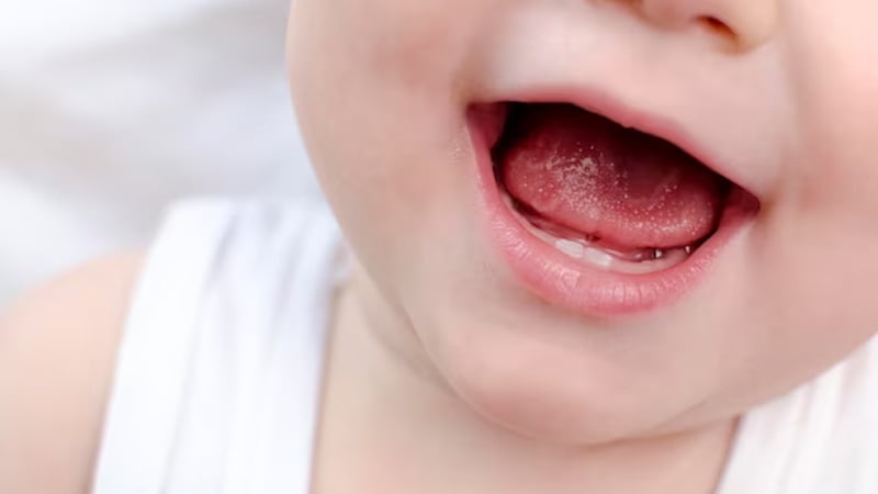 Viêm lưỡi ở trẻ em không gây nguy hiểm nhưng rất dễ tái phát và không có biện pháp điều trị triệt để