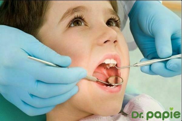 10 bệnh răng miệng phổ biến nhất hiện nay