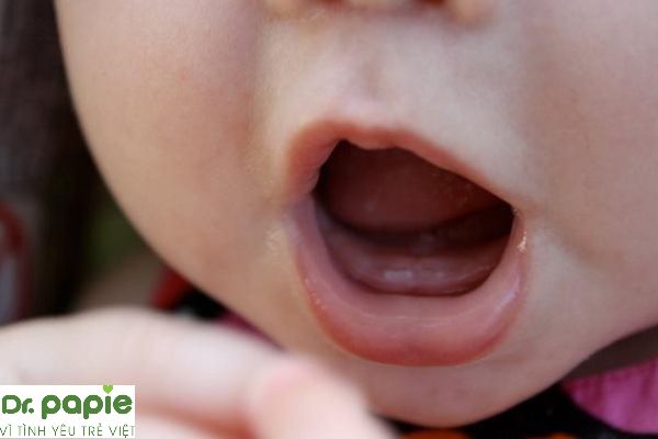 Mọc răng ở trẻ: dấu hiệu và quá trình mọc răng của trẻ mẹ nên biết