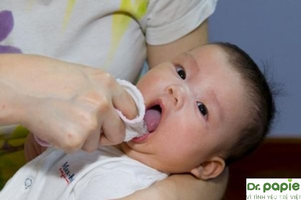 cách đánh tưa lưỡi cho trẻ sơ sinh bằng gạc