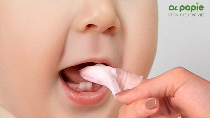 rơ lưỡi điều trị nấm lưỡi bản đồ ở trẻ em