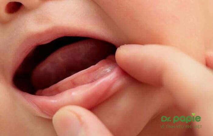 Trẻ mọc răng