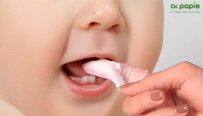 Cách trị trắng lưỡi ở trẻ sơ sinh