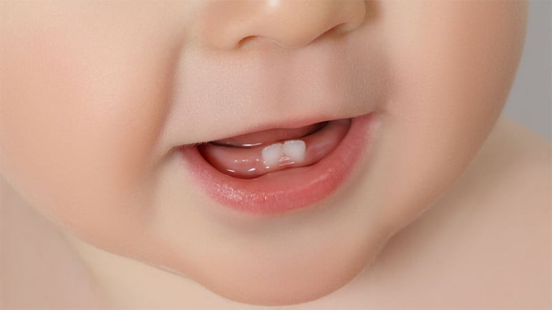 Nguyên nhân tại sao trẻ mọc răng sớm