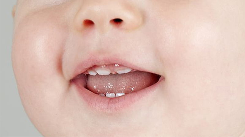 Trẻ mọc răng sớm tốt hay xấu, có phải trẻ mọc răng sớm bố mẹ khó làm ăn?