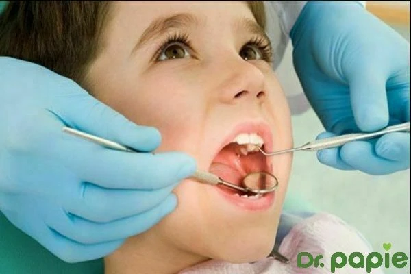 10 bệnh răng miệng ở trẻ nhỏ nghiêm trọng phổ biến nhất hiện nay 10 bệnh răng miệng phổ biến nhất hiện nay