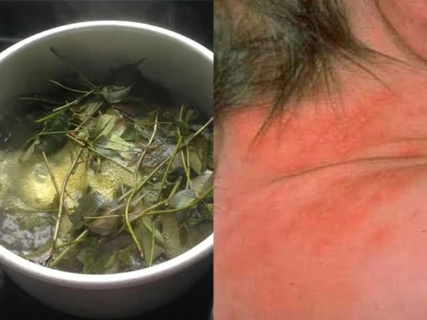 4 sai lầm tai hại của mẹ khi chọn sữa tắm cho con bé bị mẩn ngứa vì dùng nước lá tắm không sạch