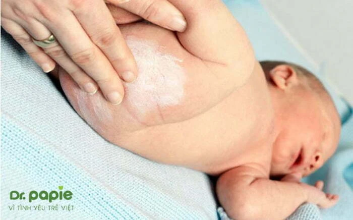 9+ cách trị hăm tã cho bé AN TOÀN áp dụng ngay tại nhà bôi phấn rôm cho trẻ bị hăm tã
