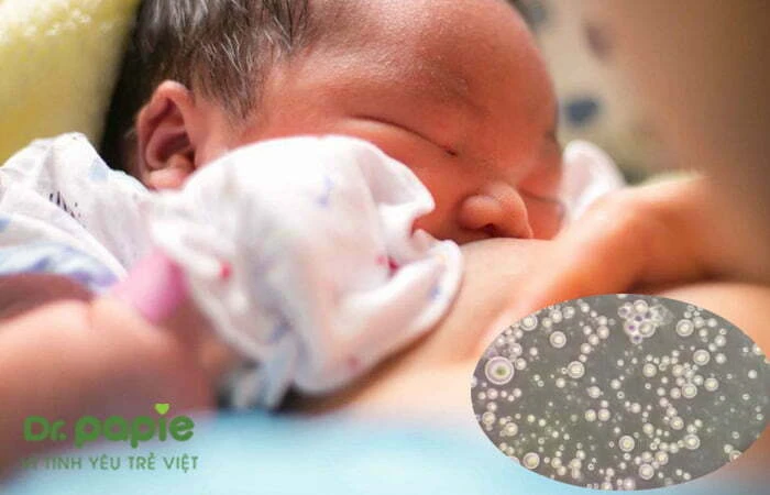 Bị chàm sữa bôi sữa mẹ có được không và cần lưu ý gì khi bôi Thành phần của sữa mẹ khi soi dưới kính hiển vi