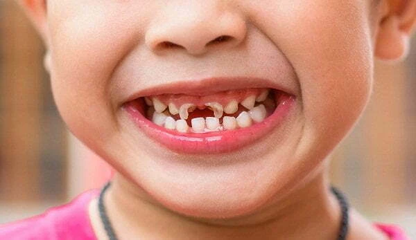 Bỏ túi gói gạc rơ lưỡi cho trẻ nhỏ bố mẹ nào cũng cần có bo tui goi gac ro luoi cho tre nho bo me nao cung can co 1