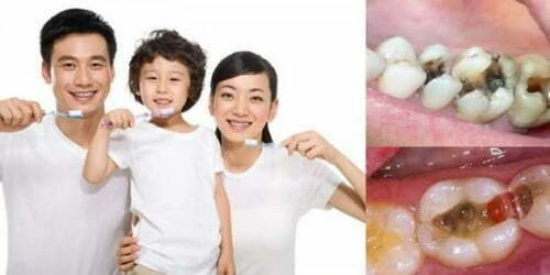 CÁCH PHÒNG TRÁNH bệnh răng miệng cho cả gia đình Đánh răng và súc miệng hàng ngày