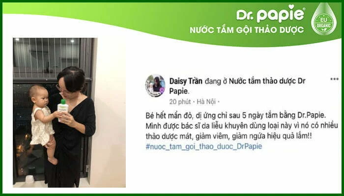 Cách trị mẩn ngứa cho bé bằng Dr.Papie nhanh chóng cach tri man ngua cho be bang dr papie nhanh chong 1