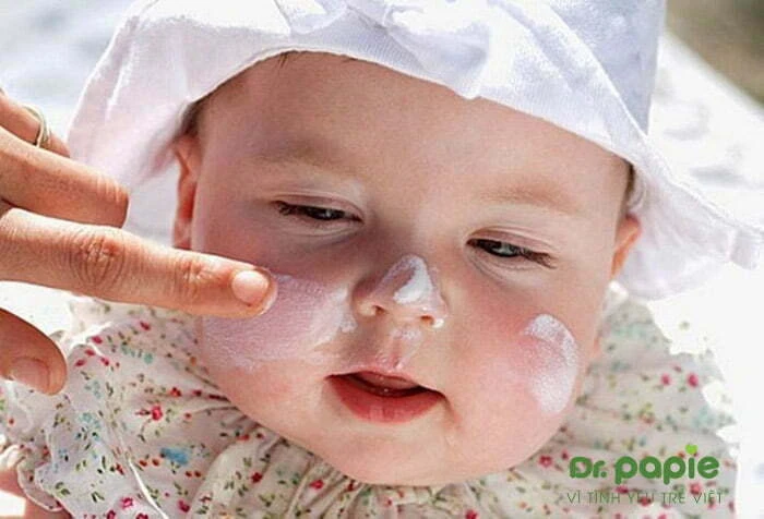Chàm sữa bị chảy nước: 3 Nguyên nhân, 8 cách chữa dứt điểm bôi thuốc trị chàm sữa bị chảy nước