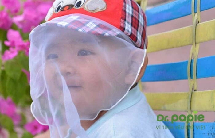 Chàm sữa có để lại sẹo không? Và cách điều trị dứt điểm chàm sữa Che khăn mỏng khi cho trẻ bị chàm sữa đi ra ngoài