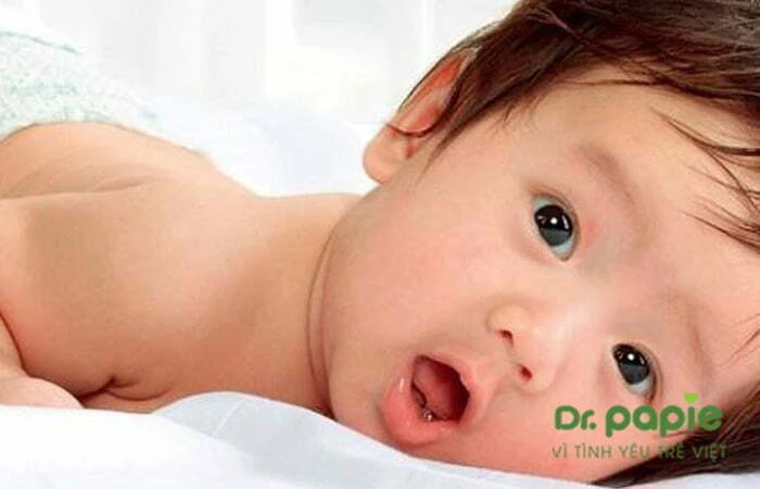 Chia sẻ mẹo mọc răng không sốt bằng lá hẹ của chuyên gia Dr.Papie Trẻ đang mọc răng