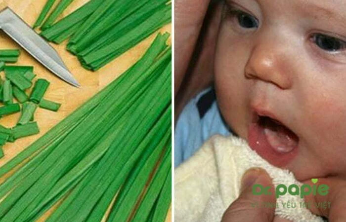 Chia sẻ mẹo mọc răng không sốt bằng lá hẹ của chuyên gia Dr.Papie Chế biến là hẹ đẻ rơ lưỡi cho trẻ sơ sinh