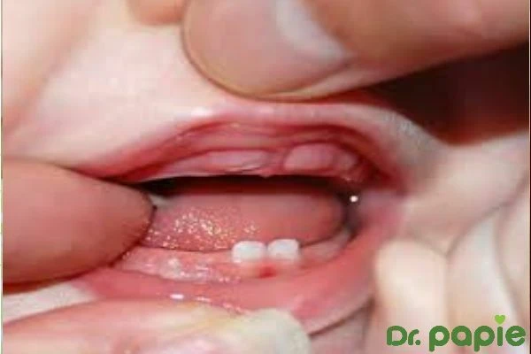 Dấu hiệu trẻ mọc răng và những lưu ý quan trọng bố mẹ cần nhớ dau hieu tre moc rang va nhung luu y quan trong bo me can nho 2