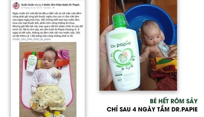Dr.Papie - Nước tắm thảo dược cho bé bị rôm sảy cực nhạy Chị Xuân chia sẻ "Tắm Dr.Papie chỉ sau 4,5 ngày bé đã hết bay rôm sảy dễ dàng. Để bé nhanh hết rôm hơn, chị kết hợp vừa tắm bé với Dr.Papie và xoa trực tiếp nước tắm lên vùng rôm mỗi ngày.