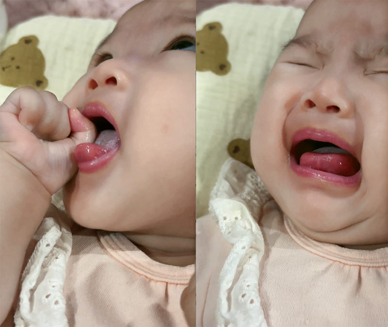 Nhật ký mẹ Gen Z: Đừng để sự chủ quan khiến con đau đớn, quấy khóc vì nấm miệng gac dr papie tro thu dac luc giup bo cham con khi me ban