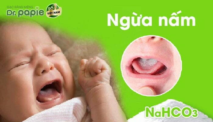 5 lợi ích vàng của Baking Soda (NaHCO3) với răng miệng NaHCO3 có tác dụng kháng nấm, làm sạch chân nấm dùng trong các bệnh nấm miệng, lưỡi, họng