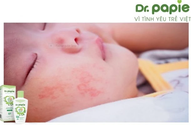 meo tri viem da co dia o tre nho