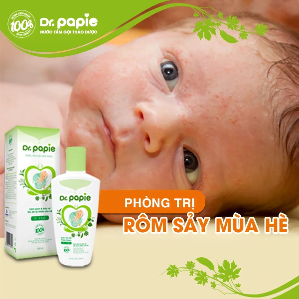 Nắng nóng ảnh hưởng thế nào tới bệnh da ở trẻ nhỏ nang nong anh huong the nao toi benh da o tre nho