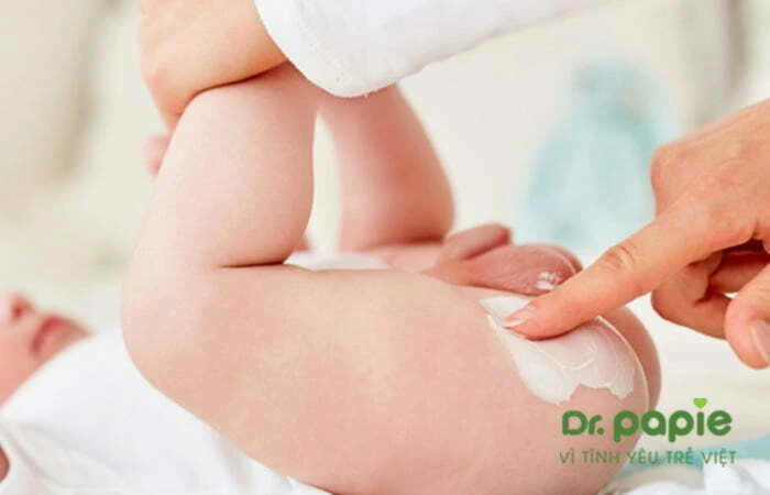 Nguyên nhân & cách phòng ngừa hăm tã trong suốt giai đoạn sơ sinh của trẻ Sử dụng kem chống hăm tã cho trẻ để ngừa hăm tã