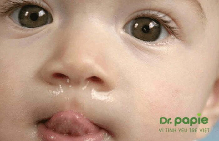 Sốt mọc răng có sổ mũi không? Nguyên nhân & cách chăm sóc tại nhà sot moc rang co so mui khong nguyen nhan cach cham soc tai nha 1