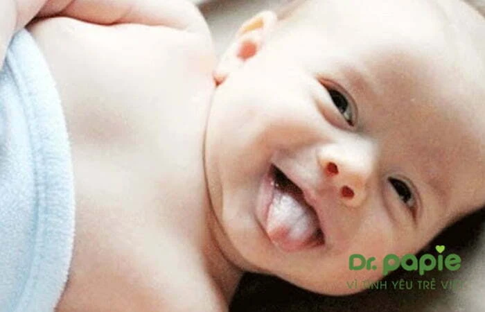Tại sao trẻ sơ sinh bị lưỡi trắng và cách điều trị theo từng nguyên nhân Trẻ sơ sinh trắng lưỡi do cặn sữa