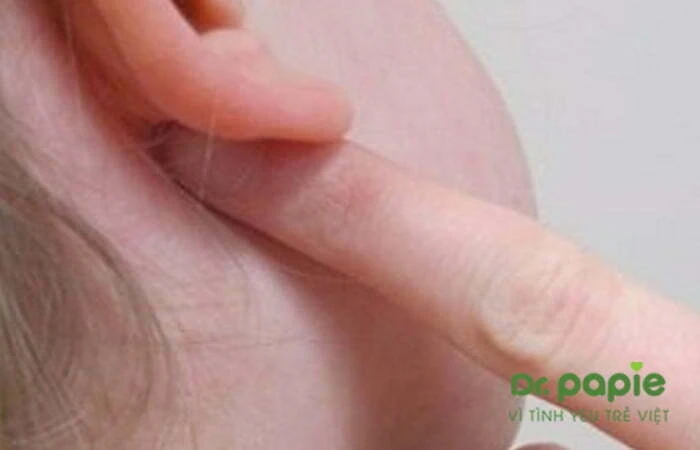 Tại sao trẻ sốt phát ban nổi hạch sau tai và 6 cách chăm sóc trẻ tại nhà Trẻ nổi hạch sau tai do sốt phát ban