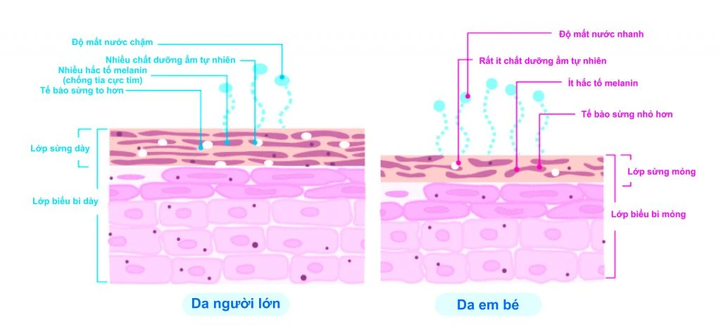 Tiến sĩ nhi cảnh báo về bệnh da trẻ em vào mua hè Da của trẻ mỏng và chưa hoàn thiện