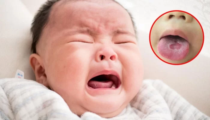 Top 4 loại gạc rơ lưỡi tốt nhất cho trẻ sơ sinh, được các bác sĩ Nhi khuyên dùng top 4 loai gac ro luoi tot nhat cho tre so sinh duoc cac bac si nhi khuyen dung 1