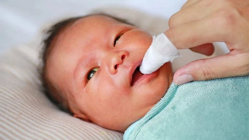 Gạc khô là loại gạc rơ lưỡi tốt, giá rẻ Gạc khô là loại gạc rơ lưỡi tốt, giá rẻ