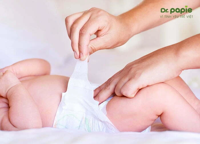 Trẻ bị hăm bỉm - Những điều quan trọng mẹ cần biết  Mặc bỉm cho bé một cách khoa học