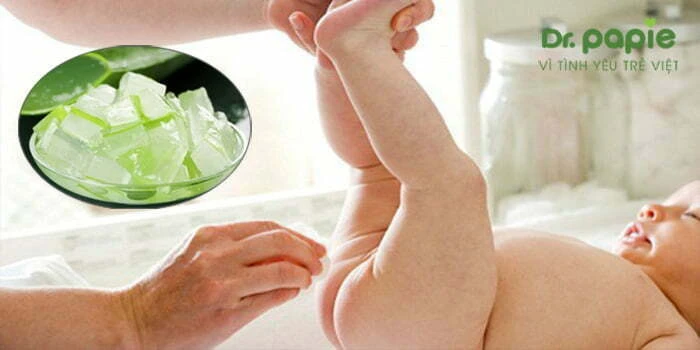 Sử dụng lô hội để trị hăm tã mùa hè cho trẻ