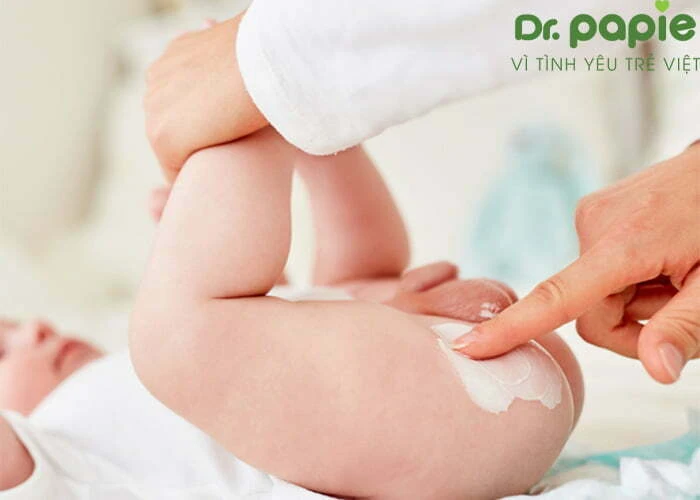 Bôi kem trị hăm cho bé