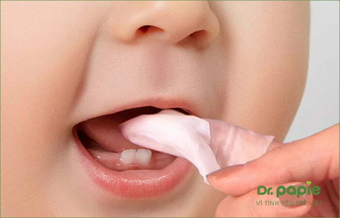 Trẻ bị tưa lưỡi uống thuốc gì? 7 thuốc được bác sĩ khuyên dùng Không rơ lưỡi quá sâu