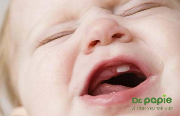 Trẻ mọc răng cửa sốt mấy ngày và cách chăm sóc giúp giảm sốt nhanh Trẻ mọc răng của trên