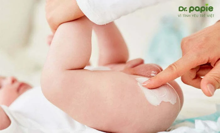 Trẻ sơ sinh bị hăm mông | Nguyên nhân và cách xử lý hiệu quả, an toàn Bôi kem trị hăm
