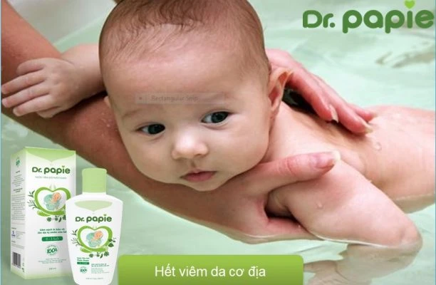 Viêm da cơ địa ở trẻ sơ sinh có chữa khỏi được không? viem da co dia o tre so sinh co chua khoi duoc khong