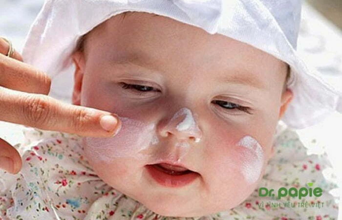 Viêm da cơ địa trẻ sơ sinh: nguyên nhân, triệu chứng & cách phòng ngừa Sử dụng kem dưỡng ẩm cho trẻ sơ sinh bị viêm da cơ địa