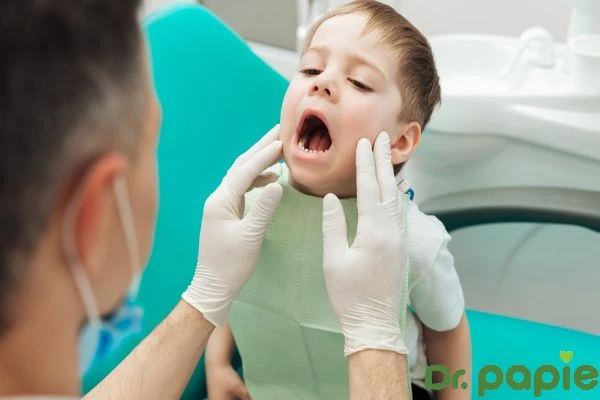 Viêm nướu ở trẻ nhỏ: Dấu hiệu và cách điều trị hiệu quả viem nuou o tre nho dau hieu va cach dieu tri hieu qua 1
